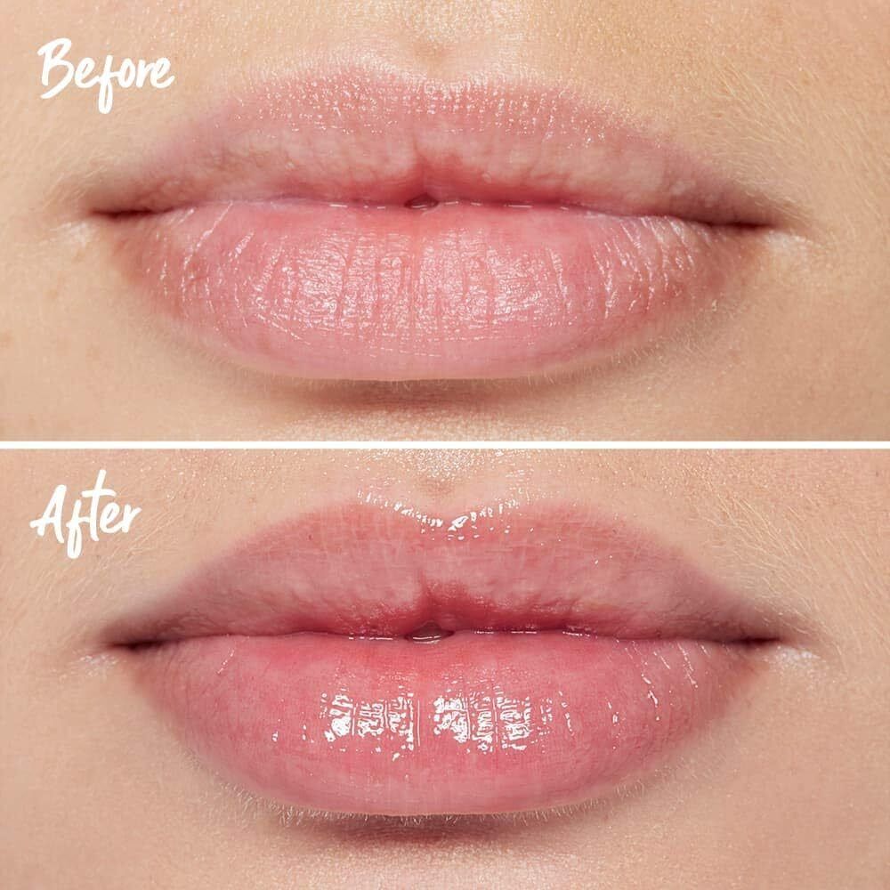 3D Lip Plumping Treatment My Instant Effects 5ml Long Lasting Fuller Lips